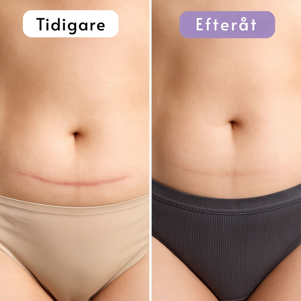 DermaSilk | Slätare hud & mindre synliga ärr