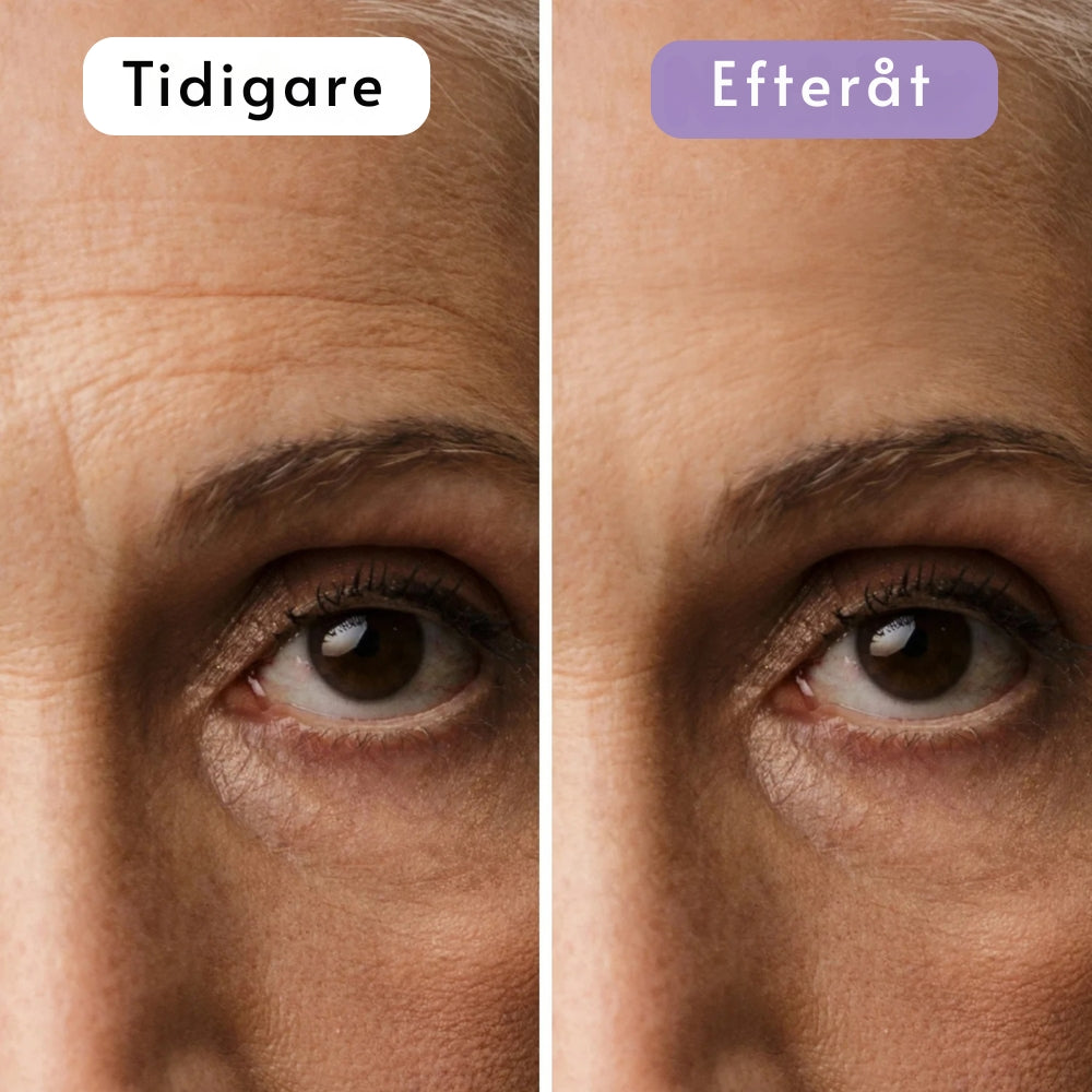 DermaSilk | Slätare hud & mindre synliga ärr