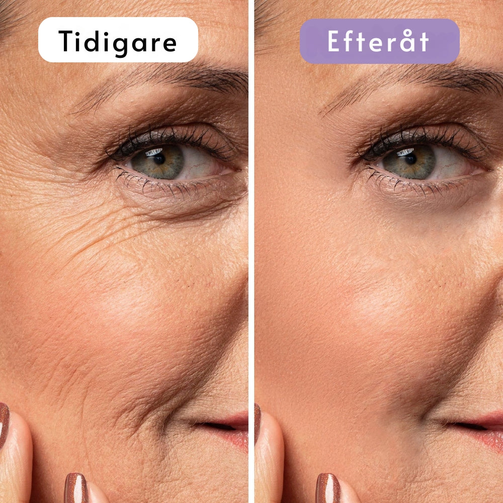 DermaSilk | Slätare hud & mindre synliga ärr